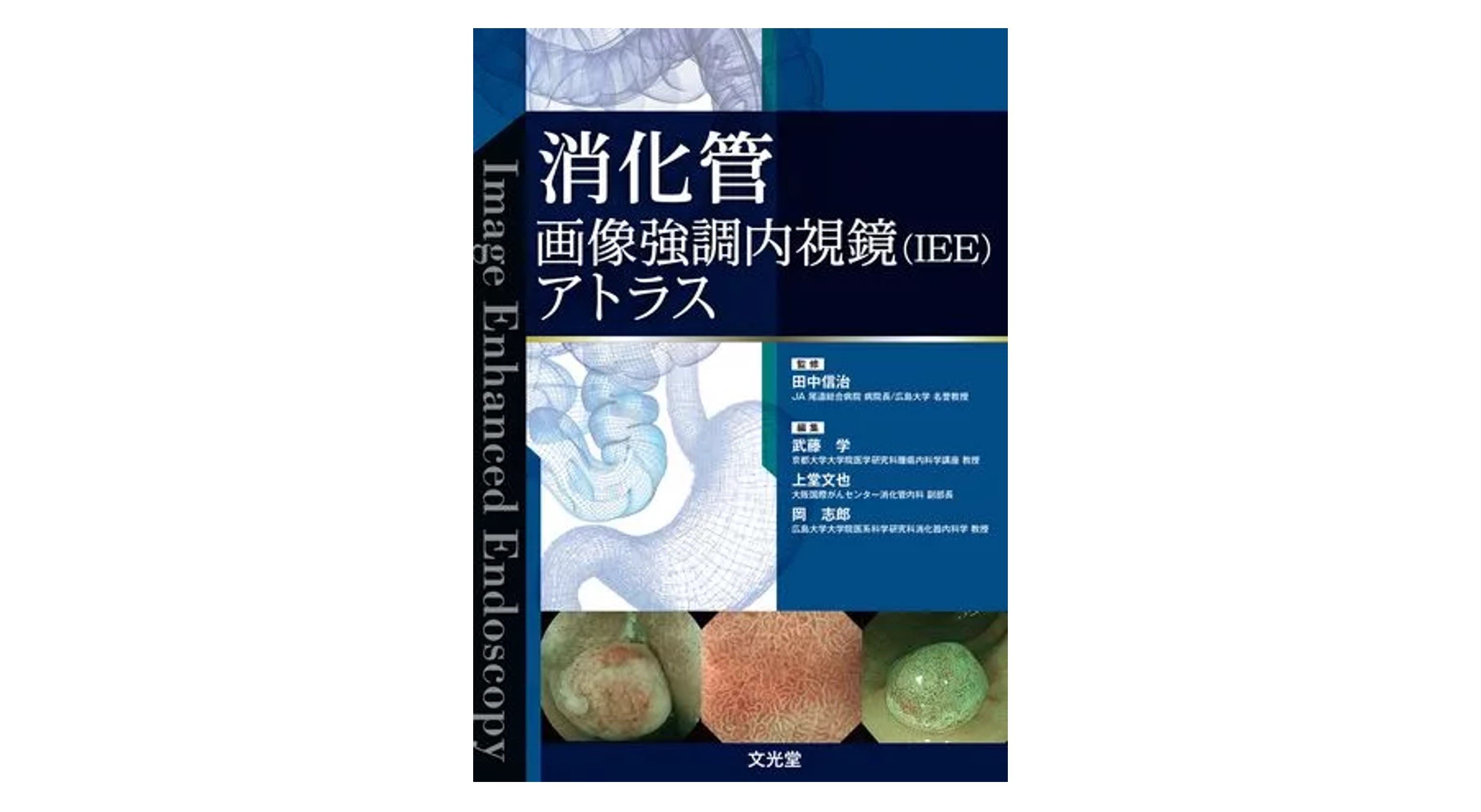 内視鏡外科医のための微細局所解剖アトラス Vol.66 No.6 内視鏡外科医のための微細局所解剖アトラス Vol.66 No.6